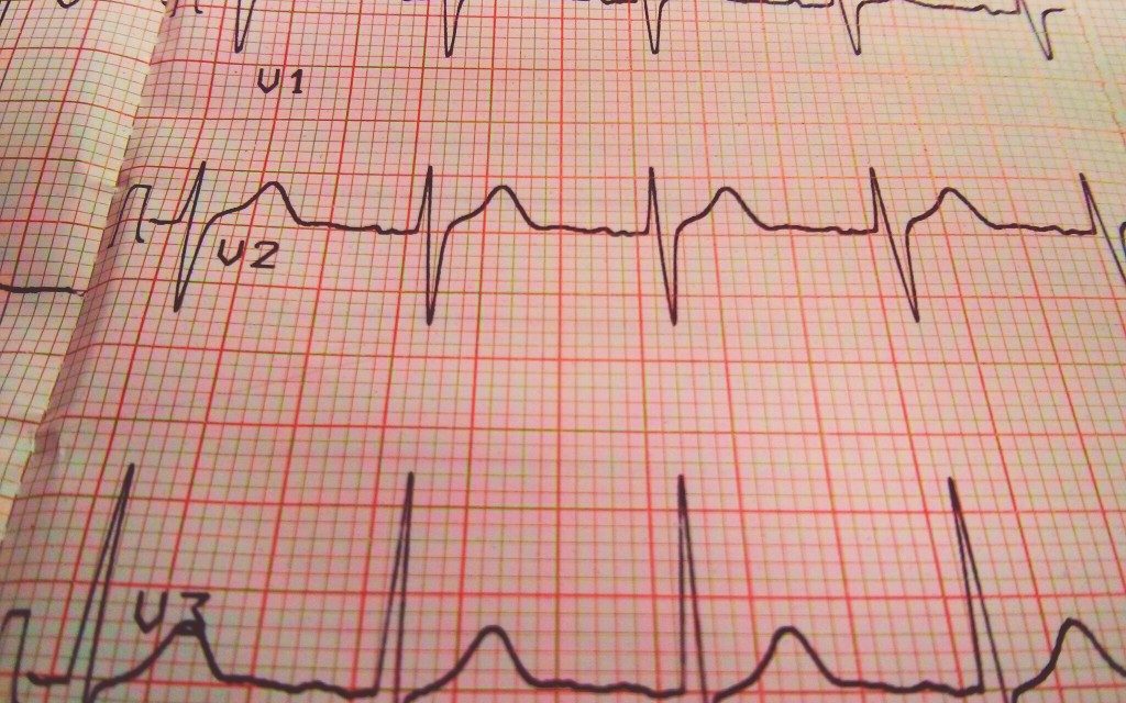 BRANDIZZO – Gli Ecg alla Casa della Salute